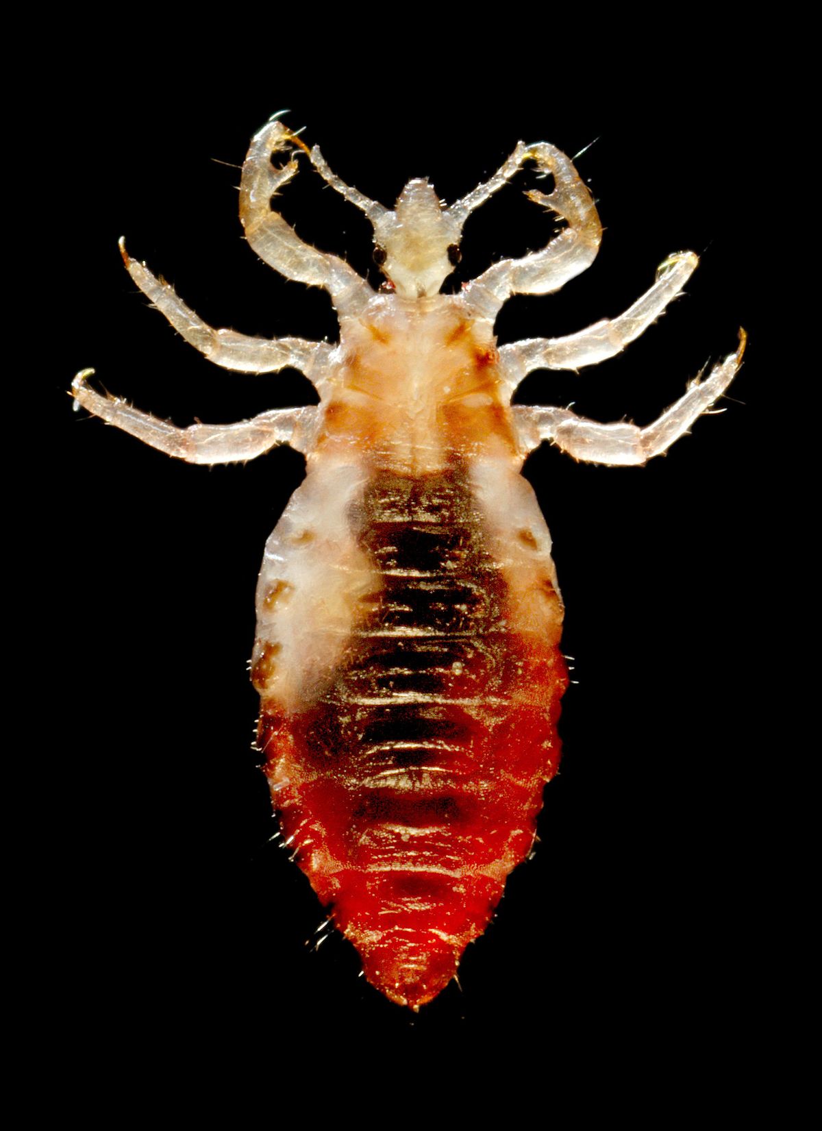 Head Lice Pictures – Louse Photo Gallery with Facts